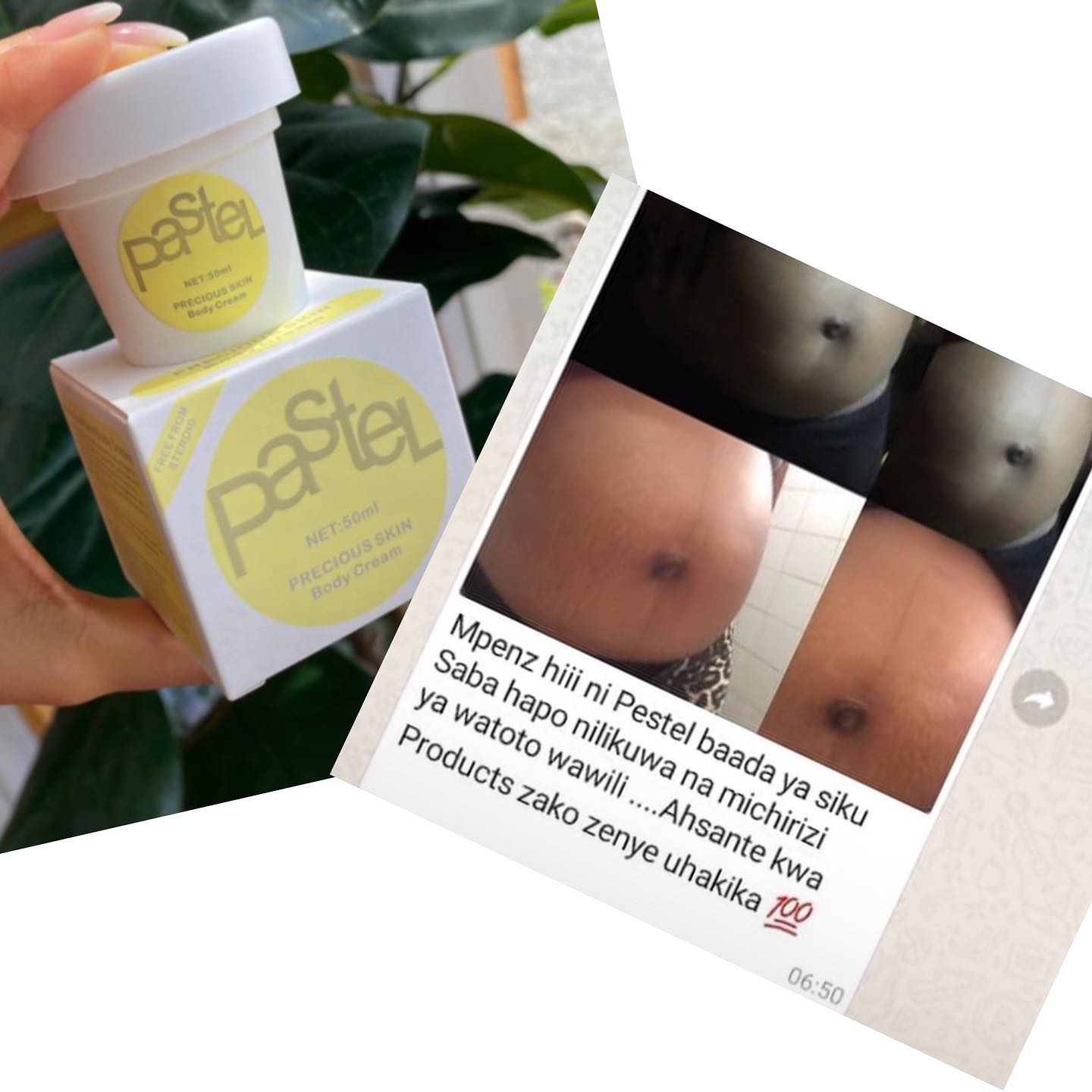 Pastel crème anti vergeture miracle originale thaïlandaise original 50 g