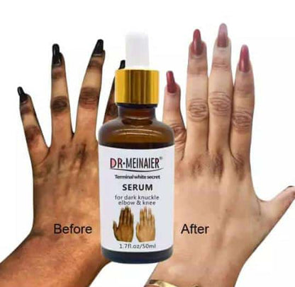 Sérum anti Quinto Dr. Meinaier pour Articulations Foncées