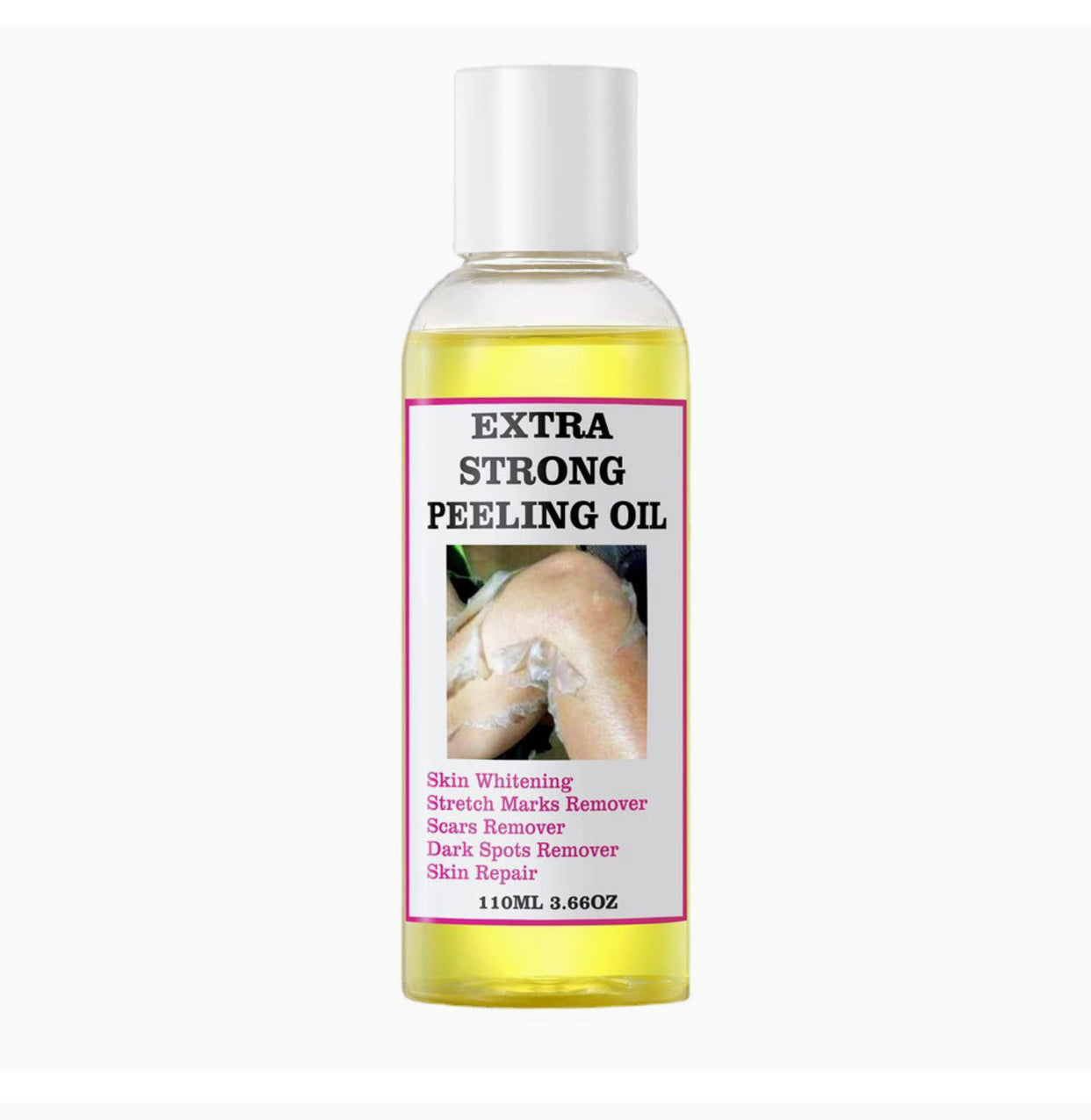 Huile de Peeling Extra forte pour l'élimination des quinto, des vergetures, des hyperpigmentations, et des cicatrices
