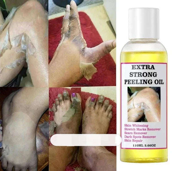 ANTI VERGETURE,TÂCHES, KINTO, ETC... 100% EFFICACE