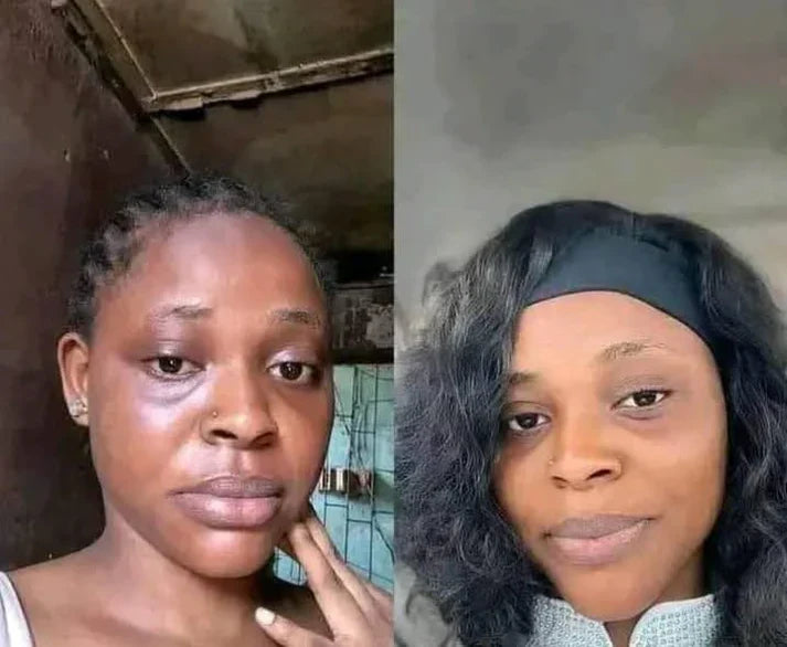 Crème Visage Kojic: Soin Complet Anti-Taches, Acné et Signes de l’Âge