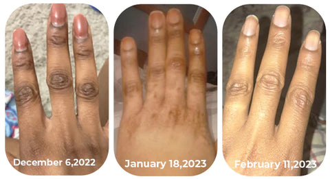 Sérum anti Quinto Dr. Meinaier pour Articulations Foncées