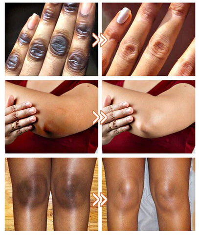 Sérum anti Quinto Dr. Meinaier pour Articulations Foncées